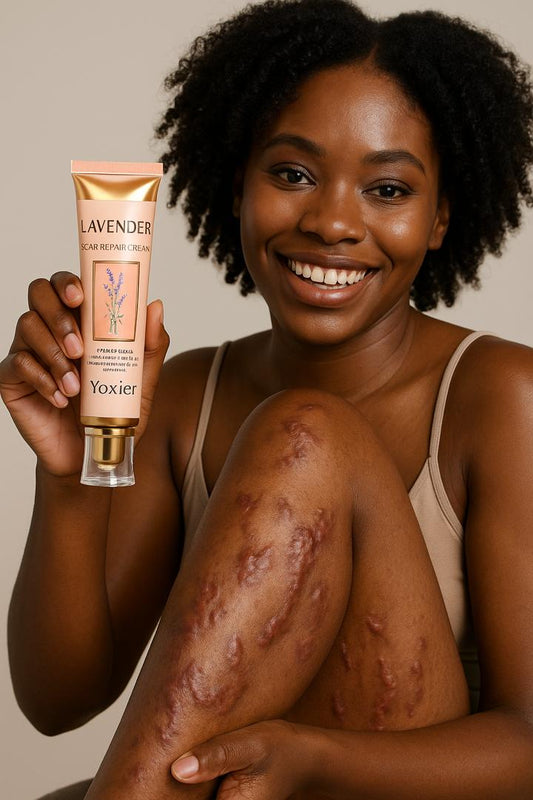 Crème Anti-Cicatrices Yoxier® à la Lavande – Répare, Apaise & Unifie la Peau