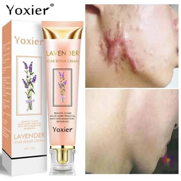 Crème Anti-Cicatrices Yoxier® à la Lavande – Répare, Apaise & Unifie la Peau