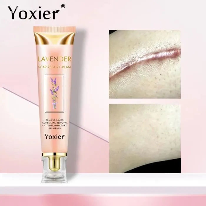 Crème Anti-Cicatrices Yoxier® à la Lavande – Répare, Apaise & Unifie la Peau
