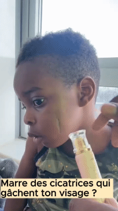 Crème Anti-Cicatrices Yoxier® à la Lavande – Répare, Apaise & Unifie la Peau