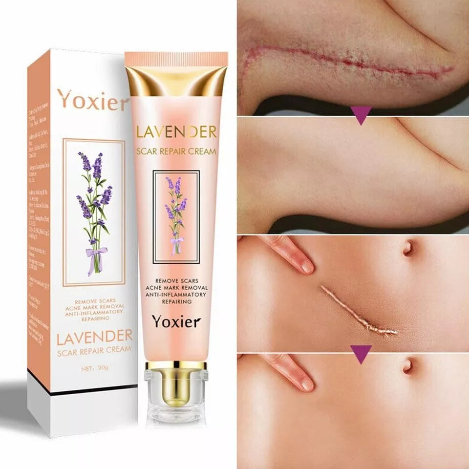 Crème Anti-Cicatrices Yoxier® à la Lavande – Répare, Apaise & Unifie la Peau